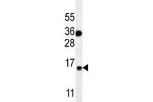 S100A1 antibody western blot analysis in MDA-MB435 lysate. (S100A1 anticorps  (AA 45-75))