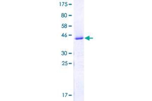 SNRNP70 Protein (AA 301-400) (GST tag)