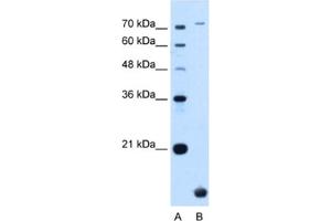 Western Blotting (WB) image for anti-Transmembrane Protein 91 (TMEM91) antibody (ABIN2463996) (TMEM91 anticorps)