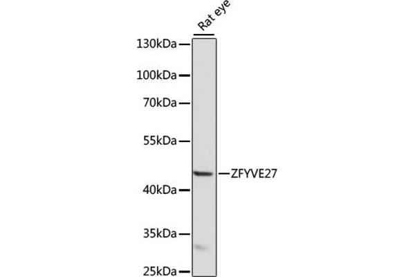 ZFYVE27 anticorps  (AA 217-411)