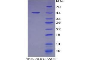 SDS-PAGE analysis of Human Hemojuvelin Protein. (HFE2 Protéine)