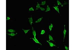 Immunofluorescent analysis of Hela cells using ABIN7173772 at dilution of 1:100 and Alexa Fluor 488-congugated AffiniPure Goat Anti-Rabbit IgG(H+L) (TNFAIP3 anticorps  (AA 97-183))