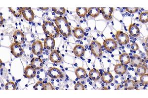 Detection of Bcl2 in Mouse Kidney Tissue using Polyclonal Antibody to B-Cell Leukemia/Lymphoma 2 (Bcl2) (Bcl-2 anticorps  (AA 2-208))