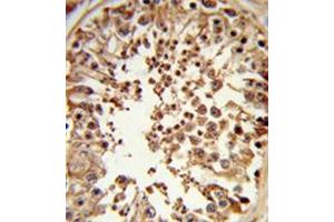 Formalin-fixed and paraffin-embedded human testis tissue reacted with DMC1 antibody (N-term) followed followed by peroxidase-conjugated secondary antibody and DAB staining. (DMC1 anticorps  (N-Term))