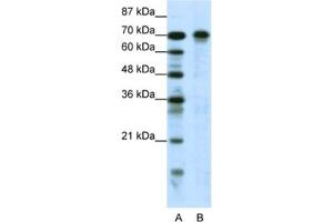 Western Blotting (WB) image for anti-HIon Channel1 antibody (ABIN2460517) (HIon Channel1 anticorps)