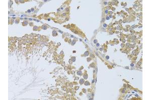 Immunohistochemistry of paraffin-embedded rat testis using ATG13 antibody (ABIN5970264) at dilution of 1/100 (40x lens). (ATG13 anticorps)