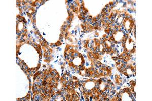 Immunohistochemistry (IHC) image for anti-Hyperpolarization Activated Cyclic Nucleotide-Gated Potassium Channel 1 (HCN1) antibody (ABIN6219949) (HCN1 anticorps)