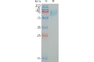Human LI Protein, His Tag on SDS-PAGE under reducing condition. (LILRA2 Protein (AA 24-449) (His tag))
