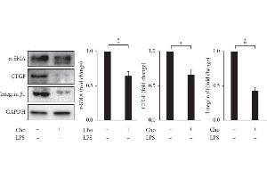 Chrysophanol (Cho) decreased the expression of α-SMA, CTGF, and integrin β-1 in HSC-T6 cells. (Smooth Muscle Actin anticorps)