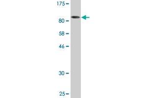 Western Blot detection against Immunogen (142. (HDAC6 anticorps  (AA 1-1063))