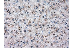 Immunohistochemical staining of paraffin-embedded liver tissue using anti-CHEK2mouse monoclonal antibody. (CHEK2 anticorps)