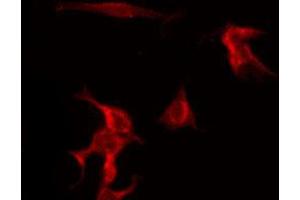 ABIN6269110 staining HuvEc by IF/ICC. (beta 2 Adrenergic Receptor anticorps  (C-Term))