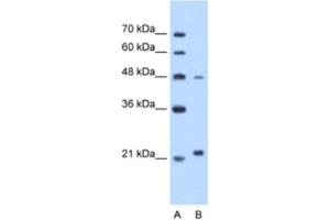 Western Blotting (WB) image for anti-Matrix Metallopeptidase 1 (Interstitial Collagenase) (MMP1) antibody (ABIN2462517) (MMP1 anticorps)