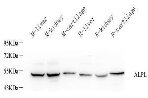 Western Blot analysis of various samples using ALPL Polyclonal Antibody at dilution of 1:1000. (ALPL anticorps)