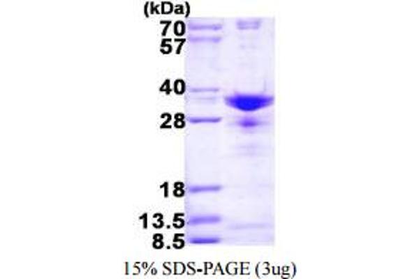 SNRPA1 Protein (AA 1-255) (His tag)