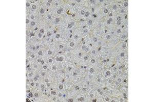 Immunohistochemistry of paraffin-embedded mouse liver using SKP2 antibody (ABIN5995995) at dilution of 1/100 (40x lens). (SKP2 anticorps)