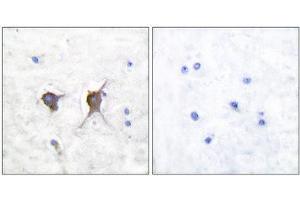 Immunohistochemistry (IHC) image for anti-BCL2-Associated X Protein (BAX) (N-Term) antibody (ABIN1848439) (BAX anticorps  (N-Term))