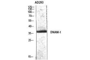 Western Blotting (WB) image for anti-CD226 (CD226) (Tyr570) antibody (ABIN3174791) (CD226 anticorps  (Tyr570))