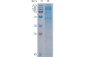 CDH19 Protein (AA 44-595) (His tag)