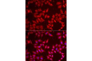 Immunofluorescence analysis of HeLa cells using BAP1 antibody (ABIN5973917). (BAP1 anticorps)