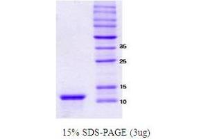 Figure annotation denotes ug of protein loaded and % gel used. (alpha Synuclein 112 (NACP112) (active) Protéine)