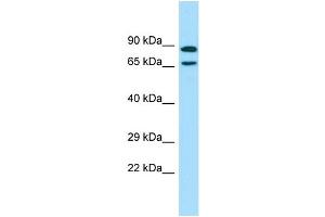 WB Suggested Anti-POF1B Antibody Titration: 1. (POF1B anticorps  (C-Term))