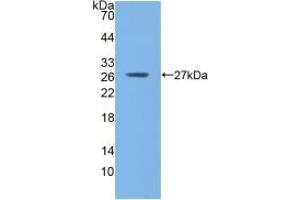 Western blot analysis of recombinant Mouse GSTm1. (GSTM1 anticorps  (AA 1-218))