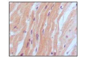 Immunohistochemical analysis of paraffin-embedded human normal myocardium, showing cytoplasmic localization using BNP2 antibody with DAB staining. (BNP anticorps)