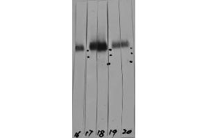 Western strip blots of HeLa cell crude extracts with two different preparations of ABIN1580432 in strips 17 and 18. (LAMP1 anticorps)