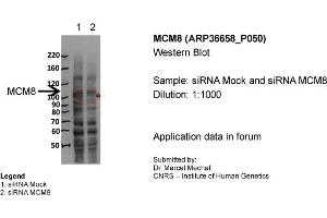 MCM8 WB Sample: siRNA Mock and siRNA MCM8 Dilution 1:1000 (MCM8 anticorps  (N-Term))