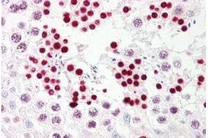 Anti-p53 antibody IHC staining of human testis. (p53 anticorps  (AA 344-393))