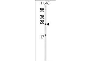 Western blot analysis of EIF4E Antibody in HL-60 cell line lysates (35ug/lane) (EIF4E anticorps)