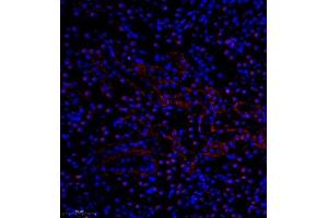 Immunofluorescence of paraffin embedded mouse nephritis using pax2 (ABIN7074974) at dilution of 1:600 (300x lens) (PAX2A anticorps)