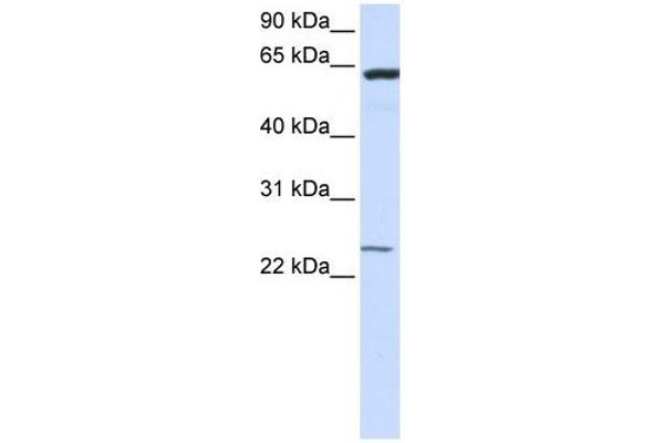 TMEM138 anticorps  (N-Term)