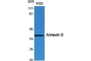 Western Blot (WB) analysis of specific cells using Annexin III Polyclonal Antibody. (Annexin A3 anticorps  (Internal Region))