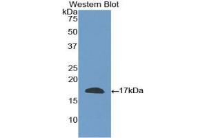 Detection of Recombinant CD40L, Human using Polyclonal Antibody to Cluster Of Differentiation 40 Ligand (CD40L) (CD40 Ligand anticorps  (AA 180-261))