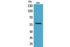 Western Blotting (WB) image for anti-Angiopoietin-Like 1 (ANGPTL1) (Internal Region) antibody (ABIN3187874) (ANGPTL1 anticorps  (Internal Region))