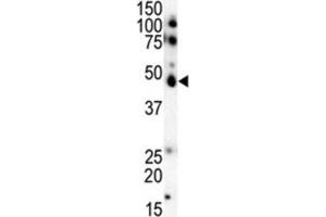 Western Blotting (WB) image for anti-Casein Kinase 1, epsilon (CSNK1E) antibody (ABIN3003191) (CK1 epsilon anticorps)