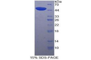 SDS-PAGE (SDS) image for Lipoprotein-Associated phospholipase A2 (Lp-PLA2) (AA 22-444) protein (His tag) (ABIN1879783) (PLA2G7 Protein (AA 22-444) (His tag))