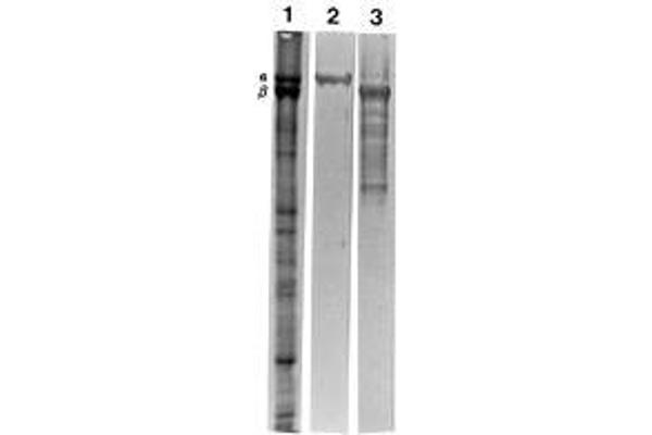 Spectrin beta Chain, Erythrocyte (SPTB) anticorps