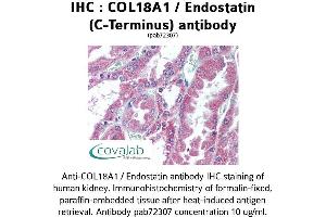 Image no. 1 for anti-Collagen, Type XVIII, alpha 1 (COL18A1) antibody (ABIN1733192) (COL18A1 anticorps)