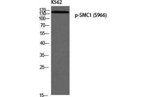 Western Blot (WB) analysis of K562 using p-SMC1 (S966) antibody. (SMC1A anticorps  (pSer966))