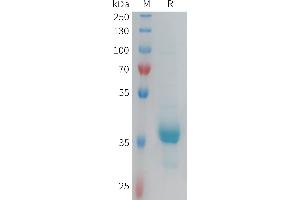 Human CX3CR1 Protein, hFc Tag on SDS-PAGE under reducing condition. (CX3CR1 Protein (AA 1-31) (Fc Tag))