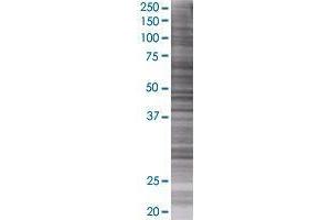 PNKD transfected lysate. (PNKD 293T Cell Transient Overexpression Lysate(Denatured))