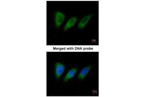 ICC/IF Image Immunofluorescence analysis of paraformaldehyde-fixed HeLa, using protein kinase N2, antibody at 1:200 dilution. (PKN2 anticorps)