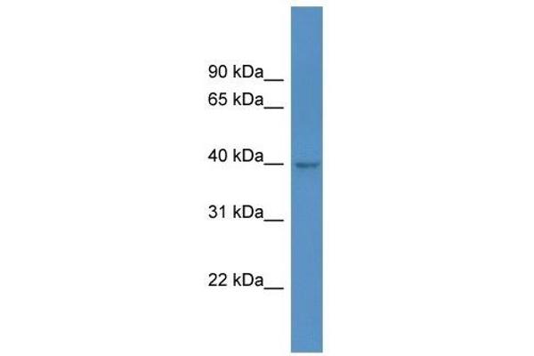 HPDL anticorps  (C-Term)