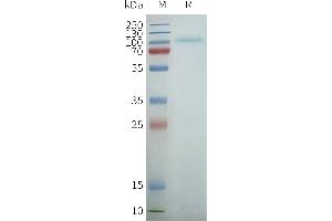 Human R2-Nanodisc, Flag Tag on SDS-PAGE (TAS1R2 Protéine)