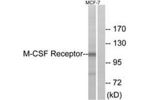 Western Blotting (WB) image for anti-Colony Stimulating Factor 1 Receptor (CSF1R) (AA 691-740) antibody (ABIN2888738) (CSF1R anticorps  (AA 691-740))