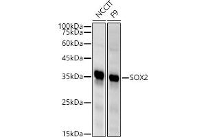 Western blot analysis of extracts of various cell lines, using SOX2 antibody (ABIN6130648, ABIN6148295, ABIN6148297 and ABIN6215241) at 1:500 dilution. (SOX2 anticorps  (AA 1-140))