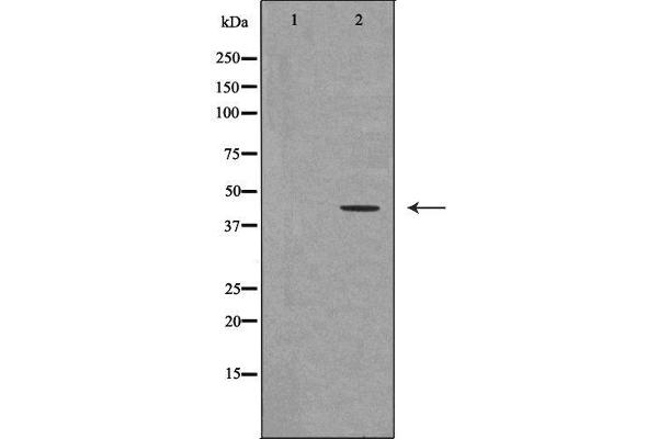 UTS2R anticorps  (C-Term)